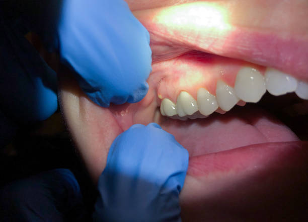 Best Emergency Dentist Near Me  in Woodridge, IL